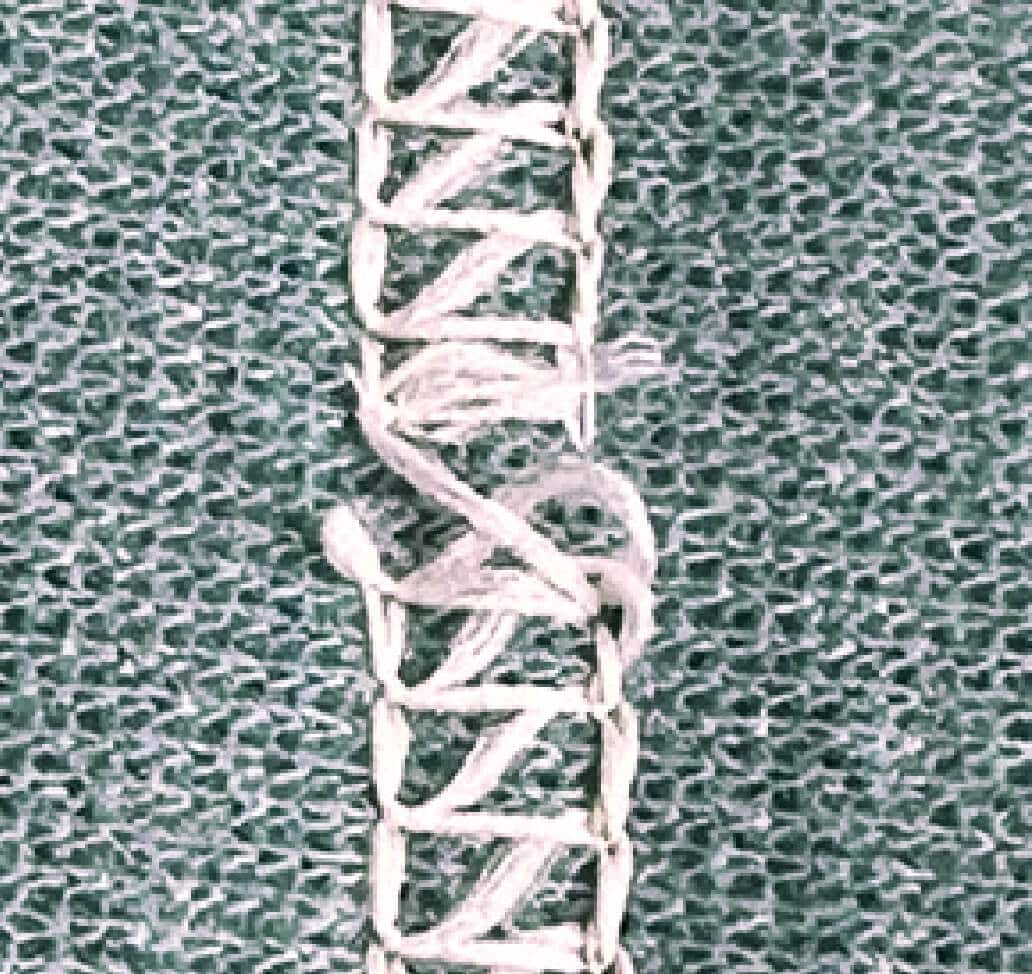 Fehlstich